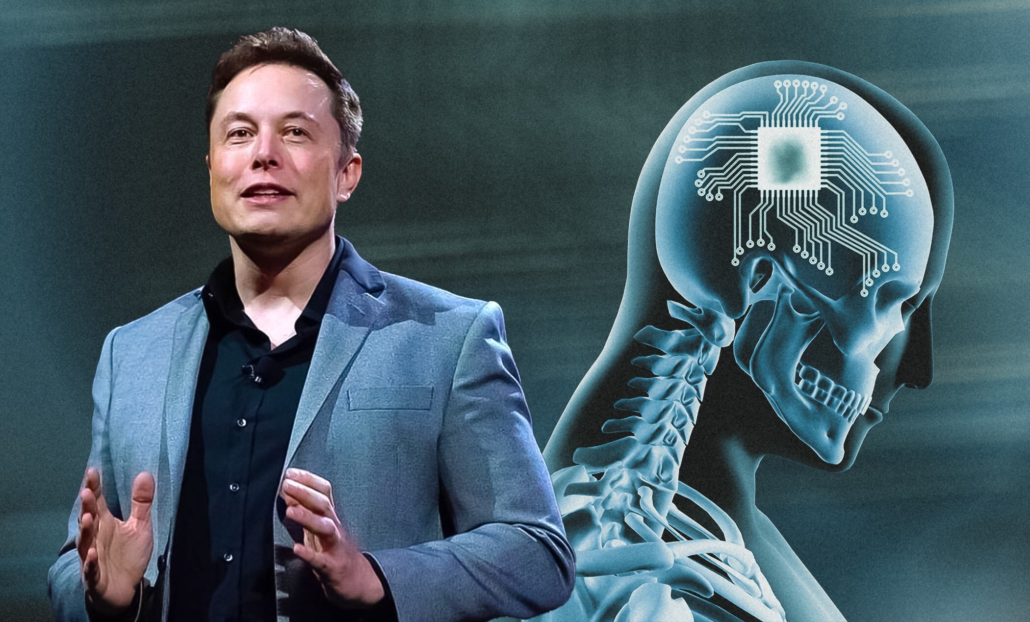 Neuralink: Musk ha rivelato che controllerà lo smartphone usando solo con il cervello